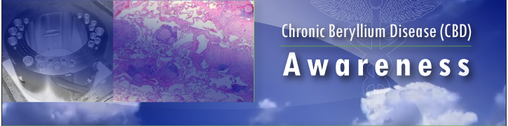 Oak Ridge National Laboratory & Image of Chronic Beryllium Disease - PathPedia.com